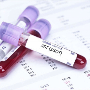 Chỉ số AST trong máu là gì và những điều bạn cần biết