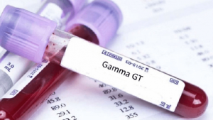 Gamma GT