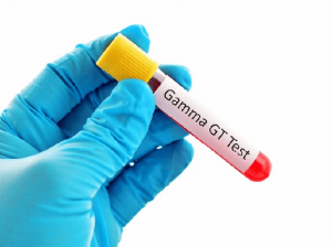Gamma gt test