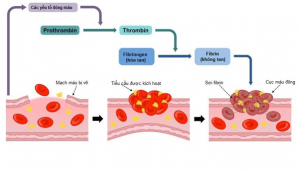 Quá trình hình thành và tiến triển của cục máu đông (huyết khối) trong cơ thể