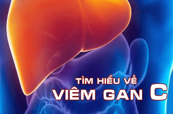 Viêm gan C có chữa được không và những điều bạn cần biết