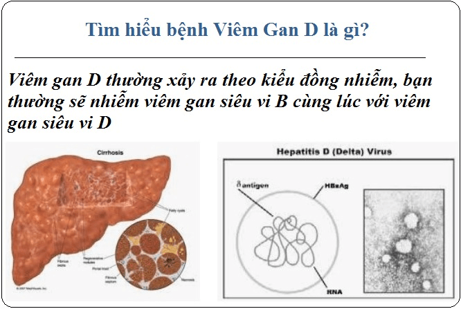 Viêm gan D: Nguyên nhân và nhưỡng điều bạn cần biết