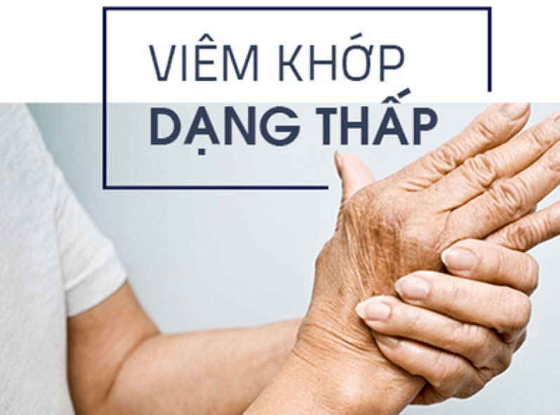 Bệnh viêm khớp dạng thấp: Dấu hiệu nhận biết và cách điều trị