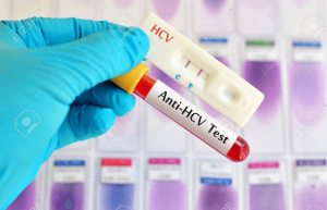 Xét nghiệm Anti HCV