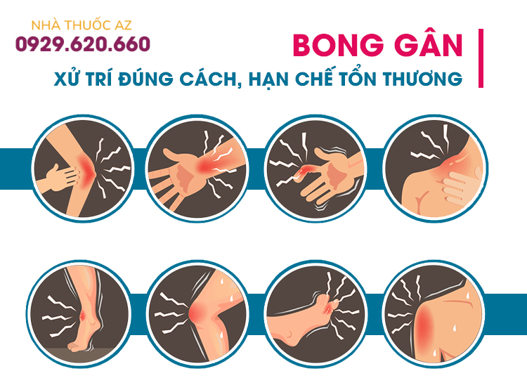 Bong gân và phương pháp điều trị