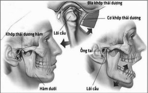 Đau xương hàm gần mang tai là bệnh gì?