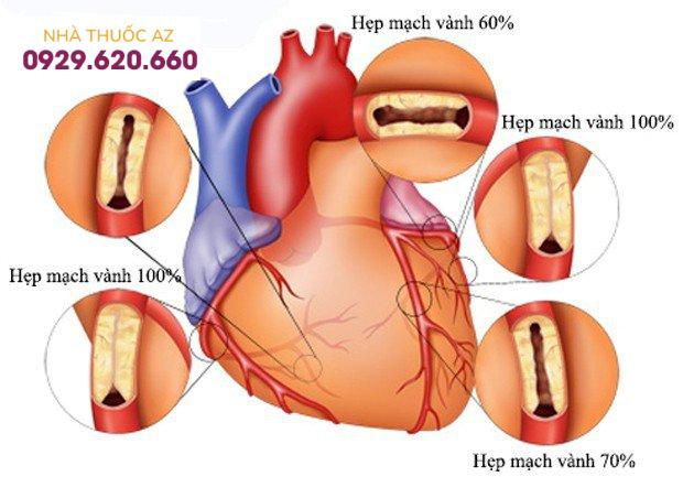hep-dong-mach-vanh-1