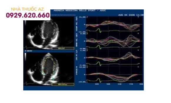 Doppler đánh dấu mô