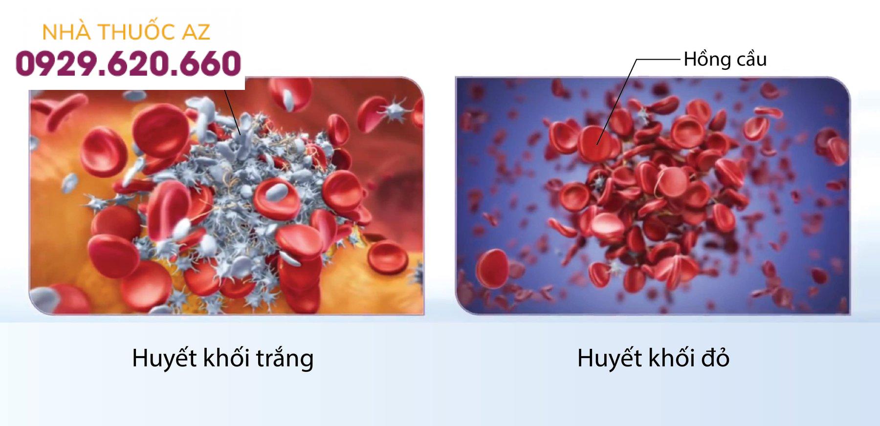 Huyết khối đỏ và huyết khối trắng