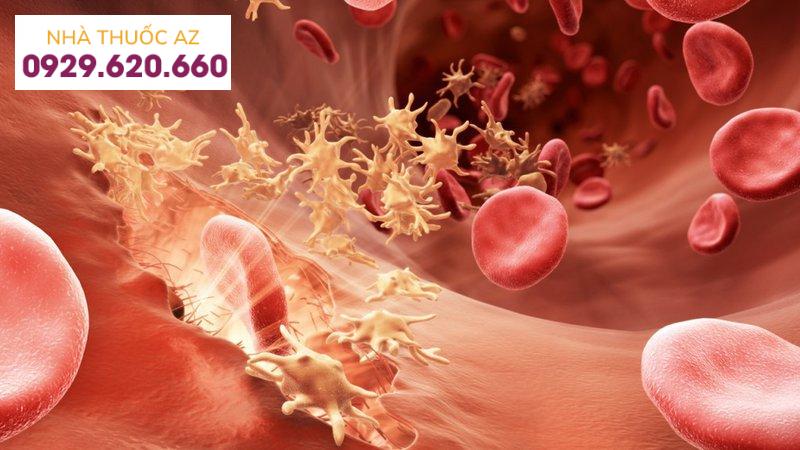 Rối loạn quá trình đông máu