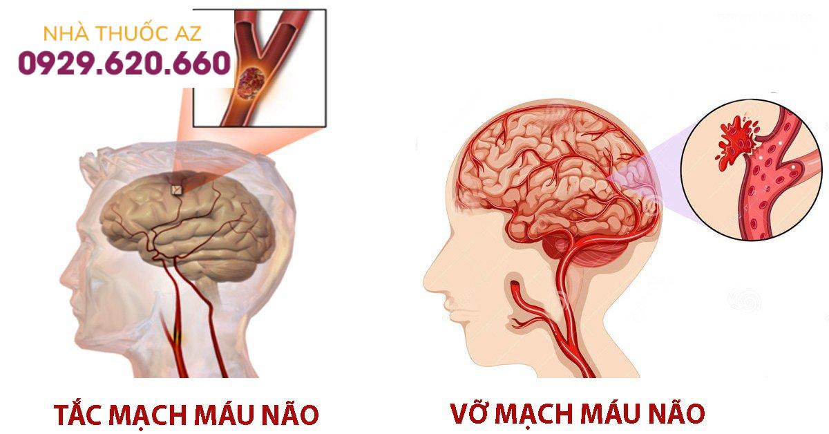 Tai biến mạch máu não