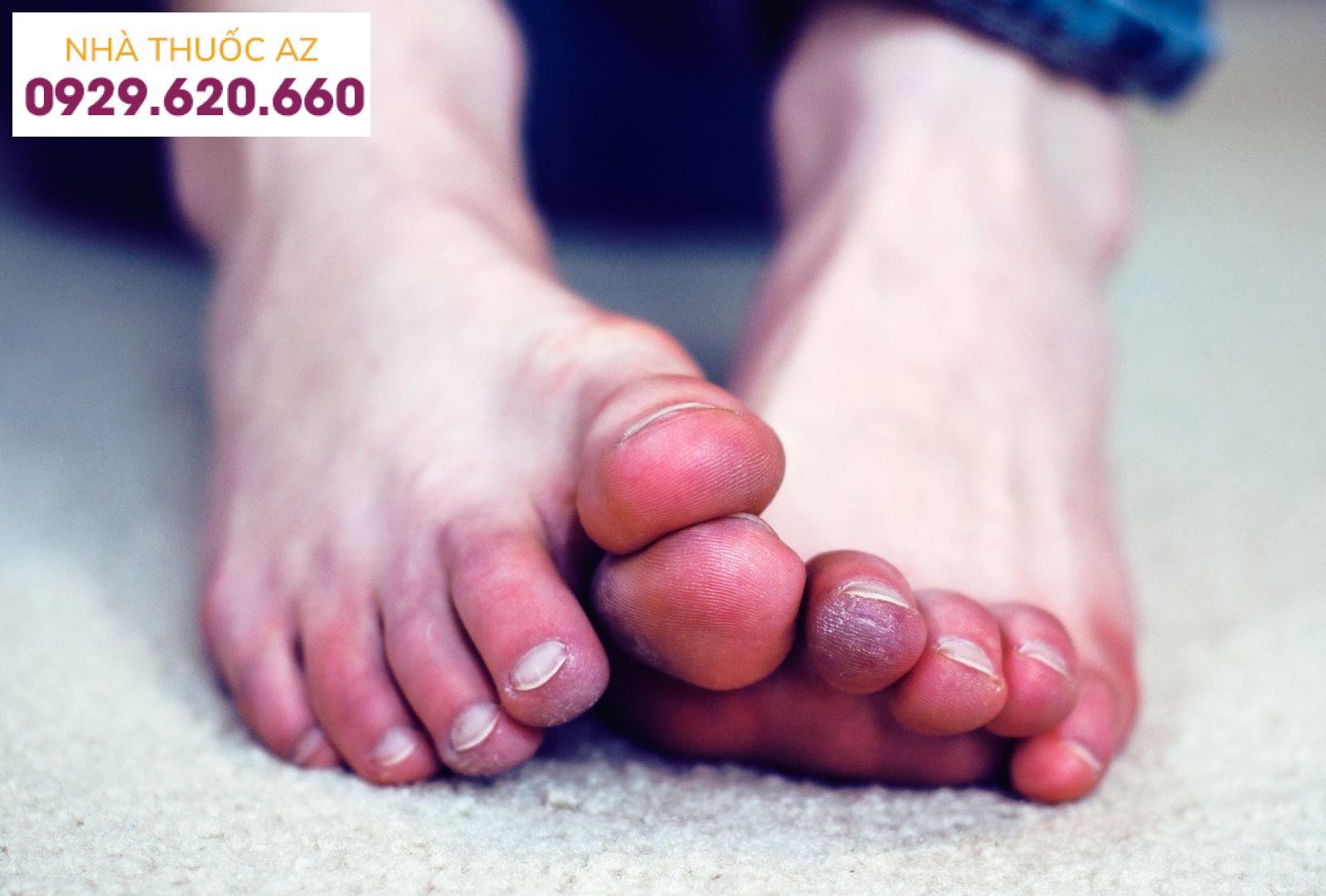 Màu sắc của ngón chân