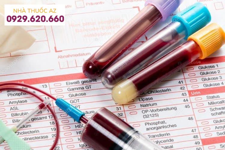 Xét nghiệm công thức máu toàn bộ giúp phát hiện ra nhiều loại bệnh