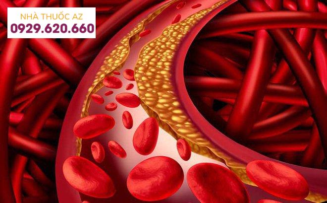 Tăng cholesterol thường gặp ở người cao tuổi