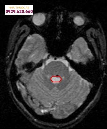 u-mau-hang-mot-di-dang-mach-nao-1