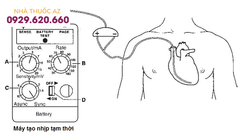 Máy tạo nhịp tim