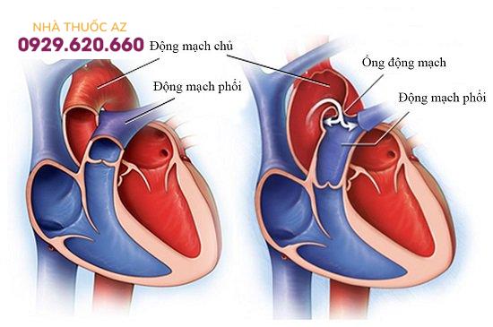 Tim có cấu tạo 4 khoang rỗng