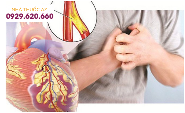 Xơ vữa động mạch