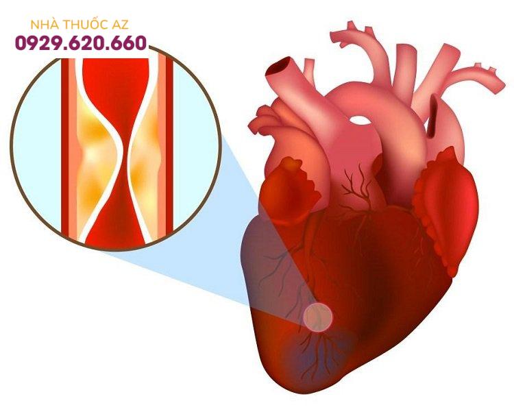 Đối tượng nào có nguy cơ cao bị nhồi máu cơ tim?