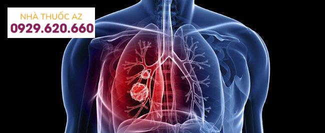 Tìm hiểu về bệnh lý tăng áp phổi