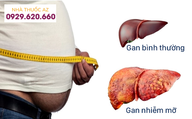 Nguyên nhân nào dẫn đến gan nhiễm mỡ?