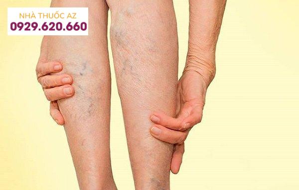 Điều trị biến chứng hậu huyết khối tĩnh mạch sâu chi dưới