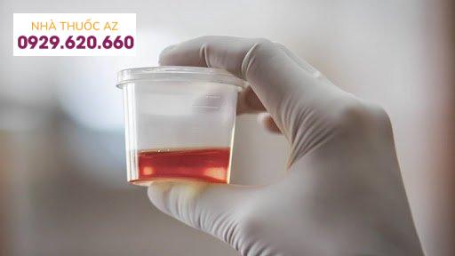 Tắc động mạch thận cấp tính có thể gây tiểu máu