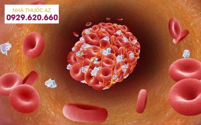 Nguyên nhân hình thành huyết khối