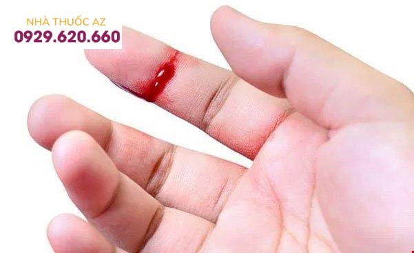 Kết dính tiểu cầu là quá trình đông cầm máu với giai đoạn đầu là hoạt hóa tiểu cầu