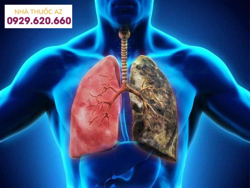 Bệnh tâm phế mạn