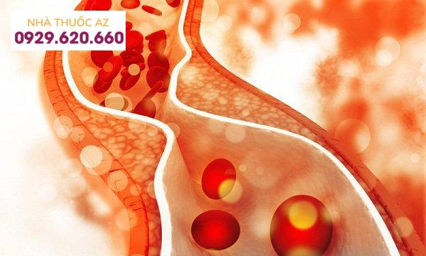 Mức độ cholesterol