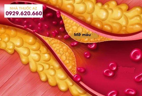 Rối loạn mỡ máu