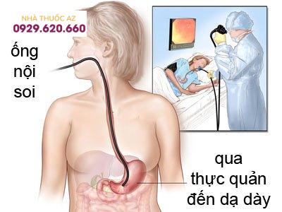 4 cách xét nghiệm phát hiện vi khuẩn HP