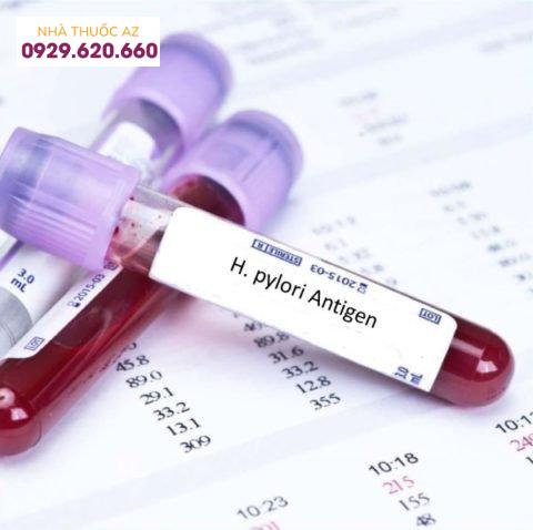 4 cách xét nghiệm phát hiện vi khuẩn HP