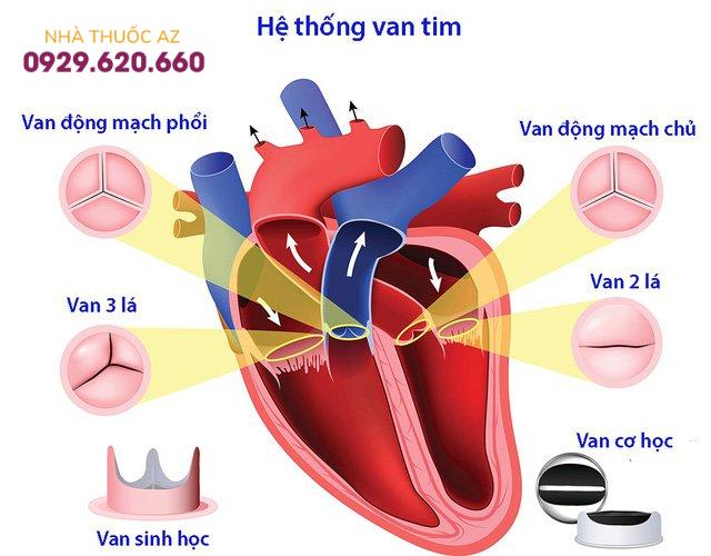 Bệnh van tim