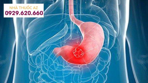 Viêm loét dạ dày