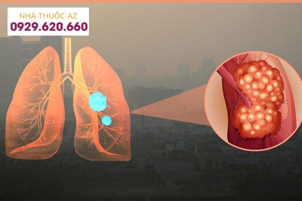 Ô nhiễm không khí