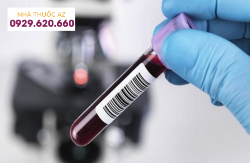 Xét nghiệm Anti-HBc IgM