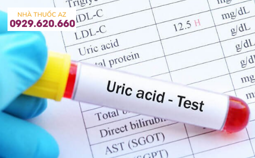 Xét nghiệm sinh hóa máu acid uric