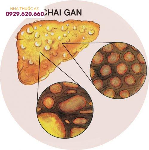 chai-gan-va-nhung-dieu-can-biet-1