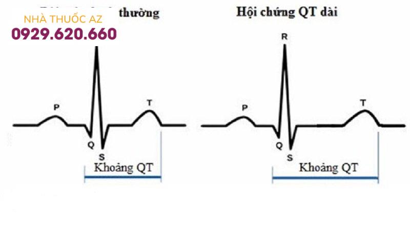 hội chứng QT dài mắc phải