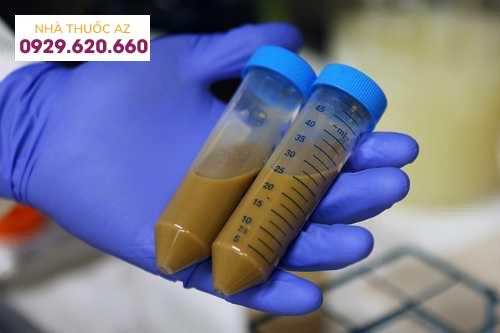 kỹ thuật ghép phân FMT