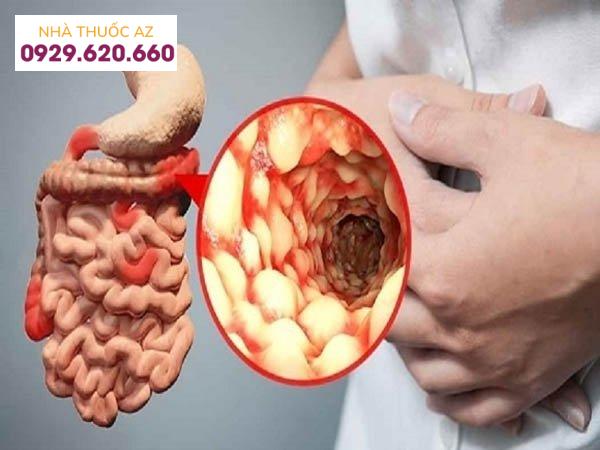Tại sao bệnh Crohn lại phổ biến ở người Do Thái?