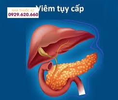 Viêm tụy cấp