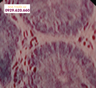 Nội soi tế bào với độ phóng đại 1390 lần