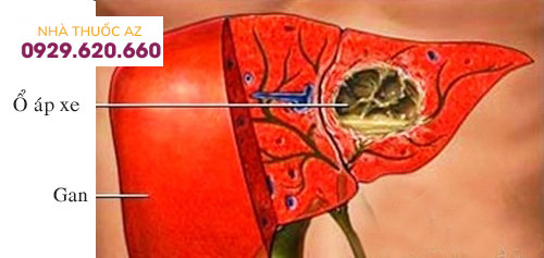 áp xe gan