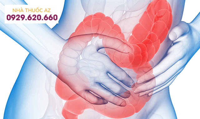 Nhận diện hội chứng ruột kích thích - phân biệt với các bệnh tiêu hóa