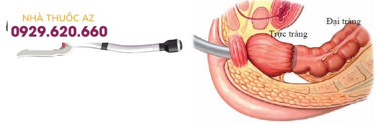 Mổ nội soi cắt đại tràng: Khi nào cần thực hiện?