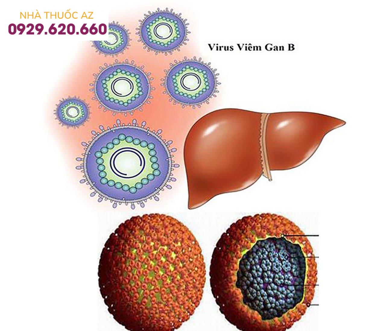 viêm gan B