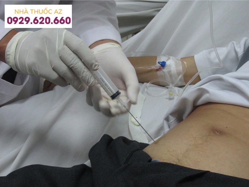 Chọc hút dịch xoang bụng